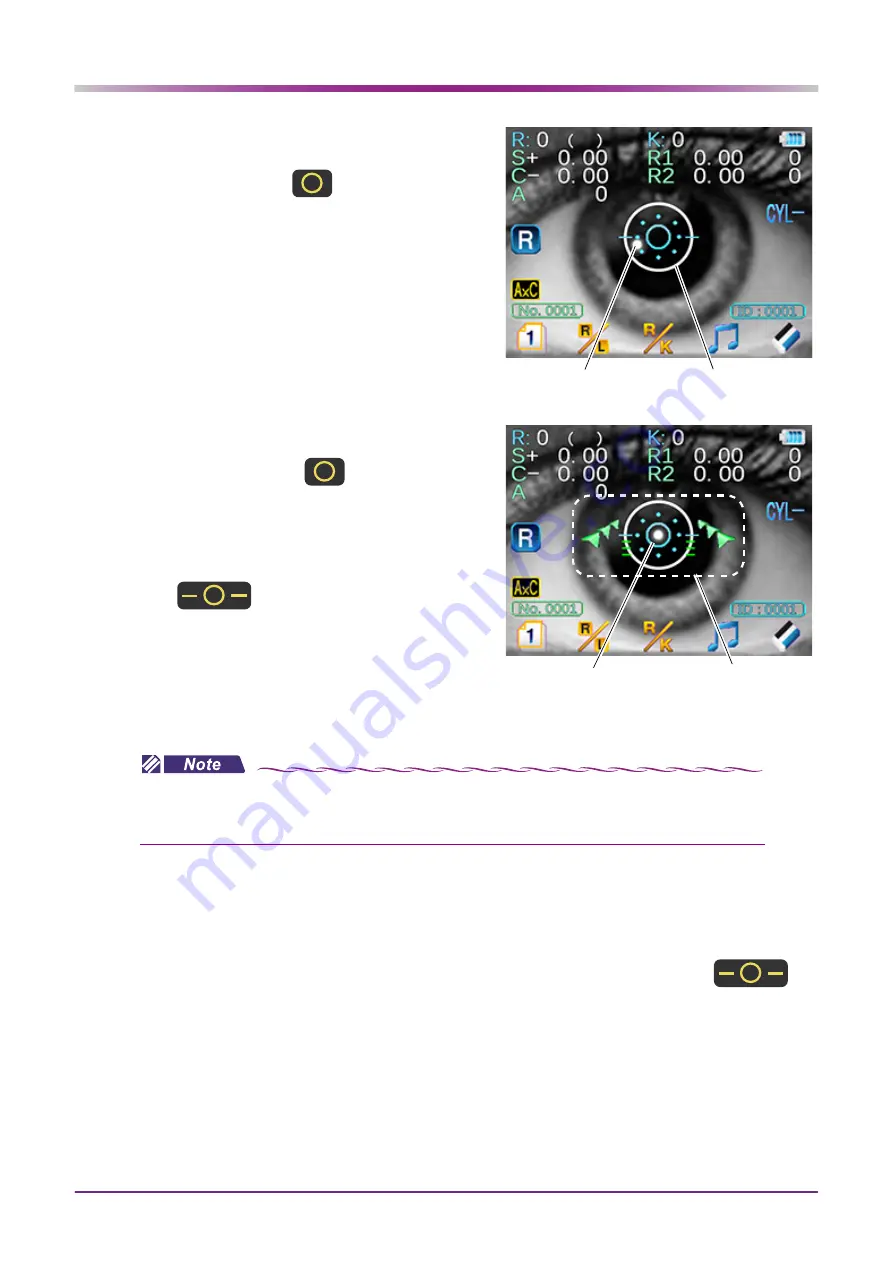 Nidek Medical HandyRef-K Operator'S Manual Download Page 58