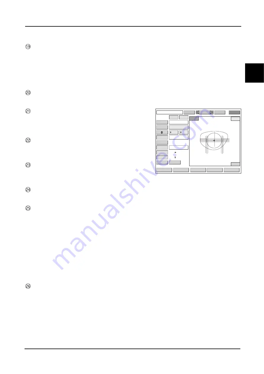 Nidek Medical ICE mini Operator'S Manual Download Page 19