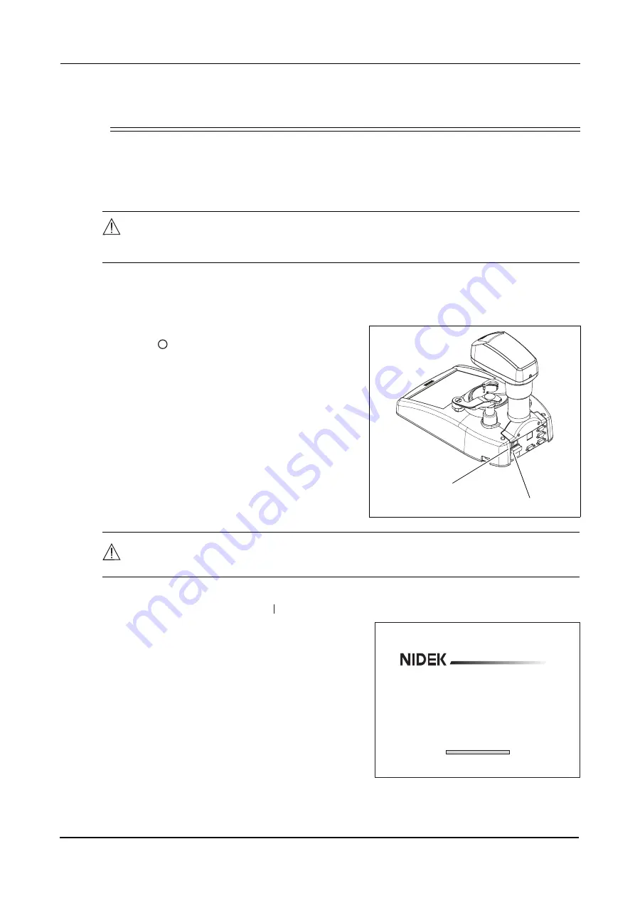 Nidek Medical ICE mini Operator'S Manual Download Page 26