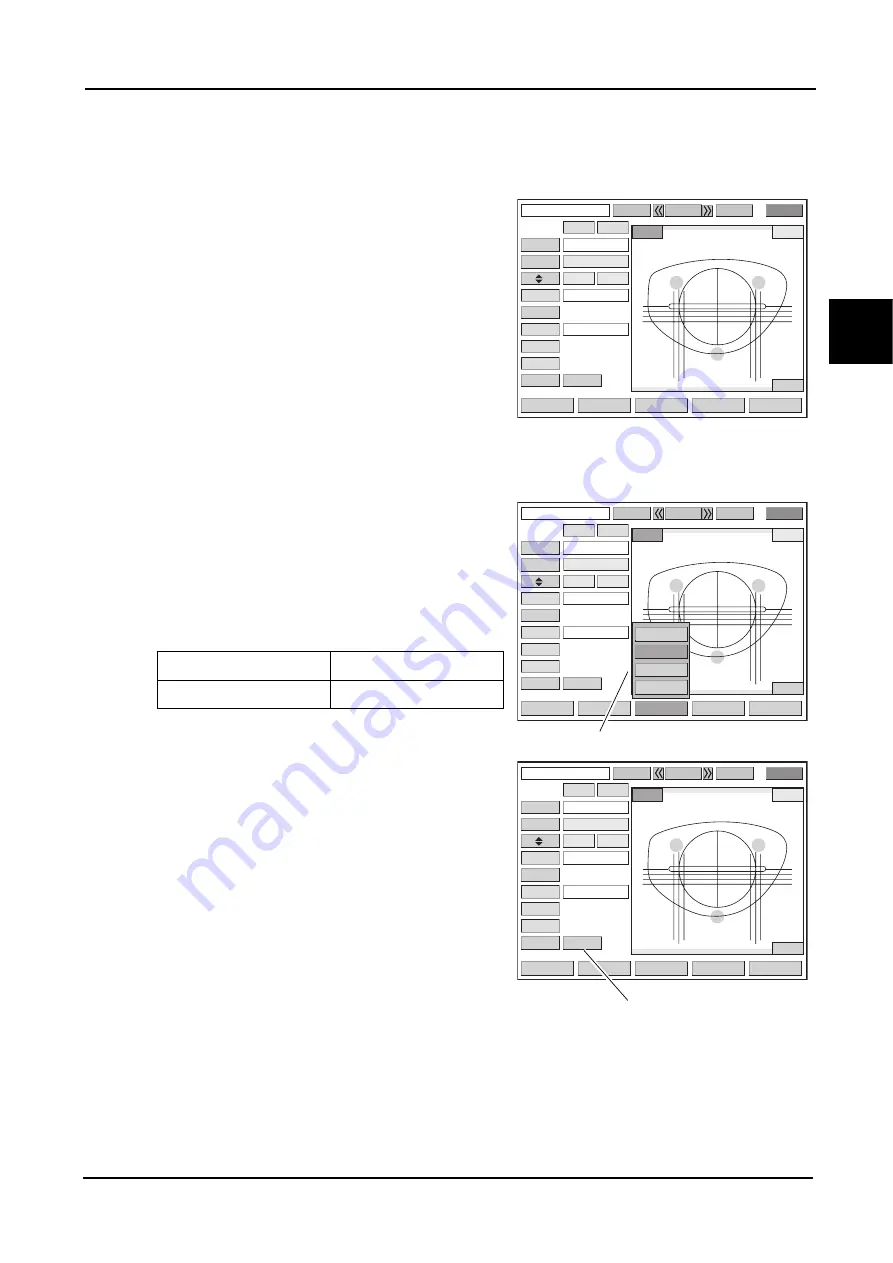 Nidek Medical ICE mini Operator'S Manual Download Page 43