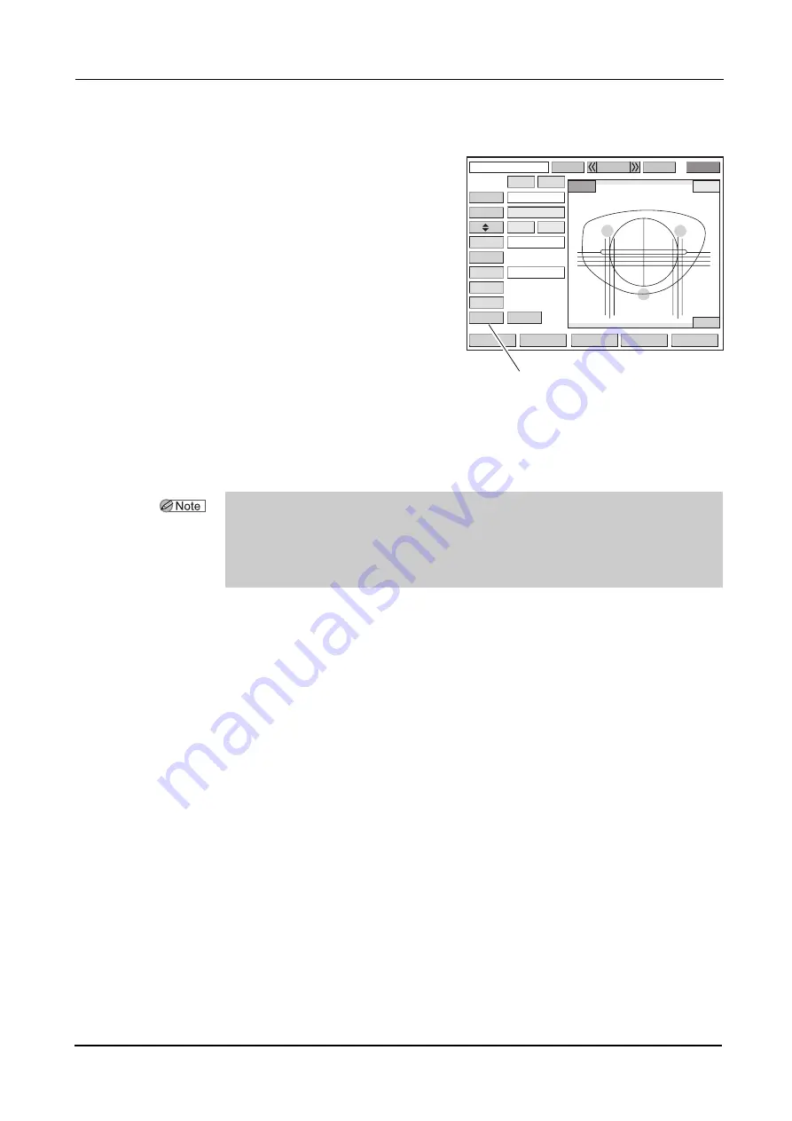 Nidek Medical ICE mini Operator'S Manual Download Page 46