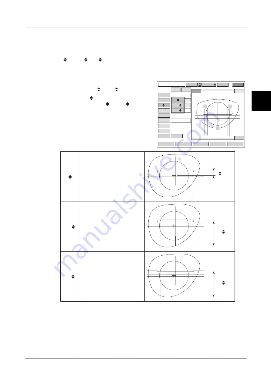 Nidek Medical ICE mini Operator'S Manual Download Page 49