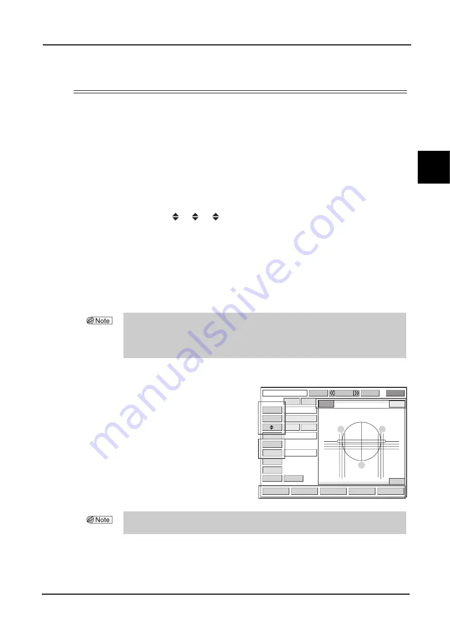 Nidek Medical ICE mini Operator'S Manual Download Page 65