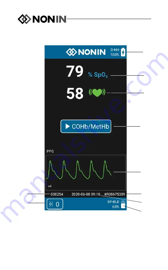 Nonin CO-Pilot H500 Operator'S Manual Download Page 18