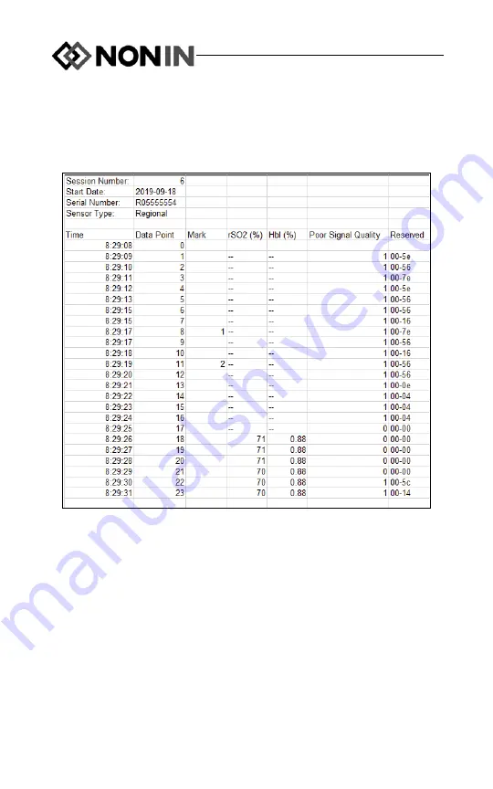 Nonin CO-Pilot H500 Operator'S Manual Download Page 38