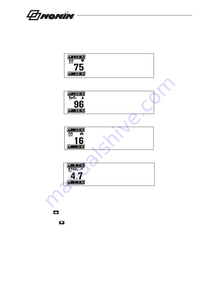 Nonin LifeSense LS1-9R Operator'S Manual Download Page 30