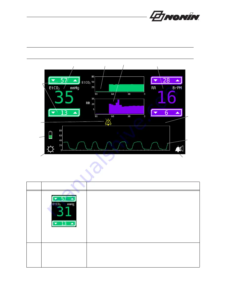 Nonin RespSense II LS1R Operator'S Manual Download Page 23