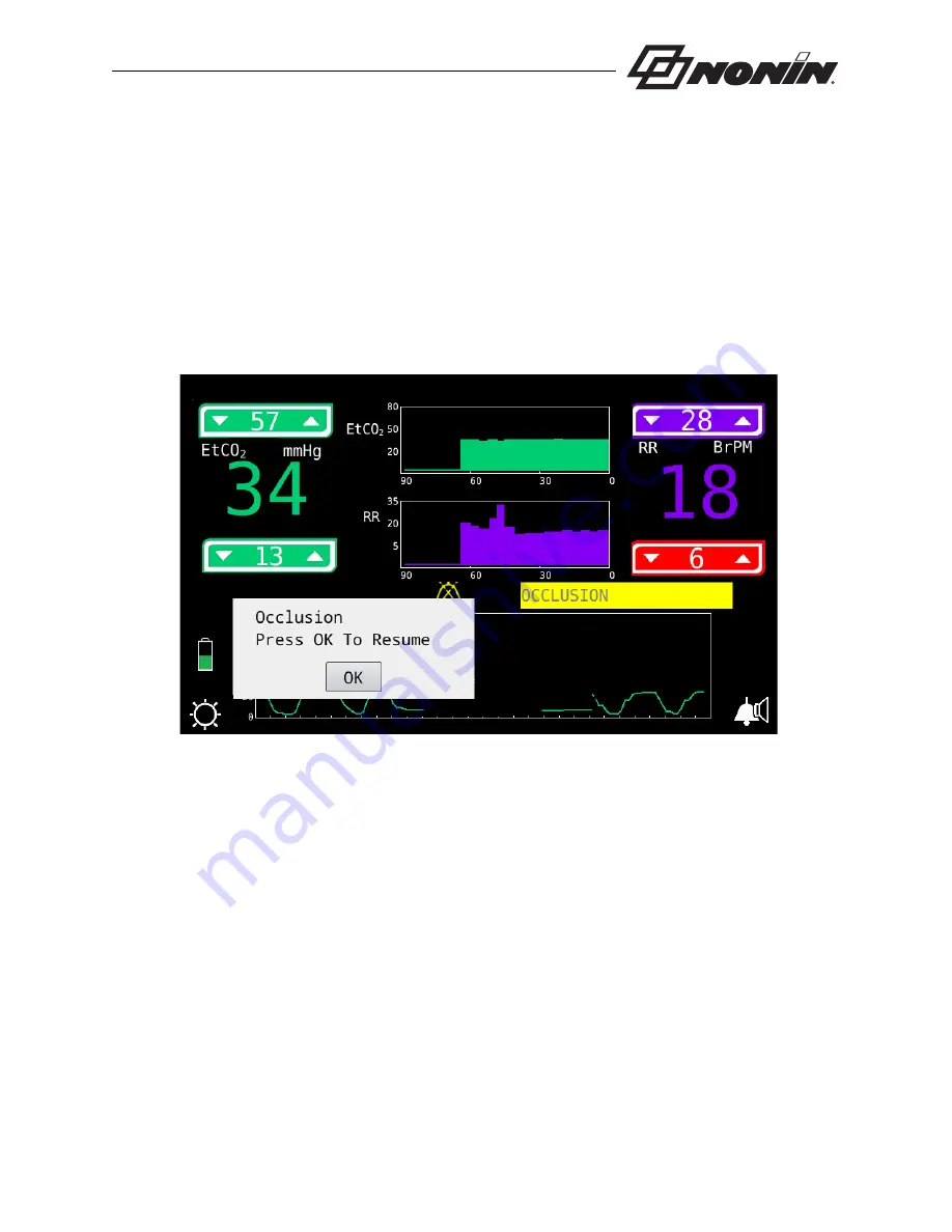 Nonin RespSense II LS1R Operator'S Manual Download Page 41