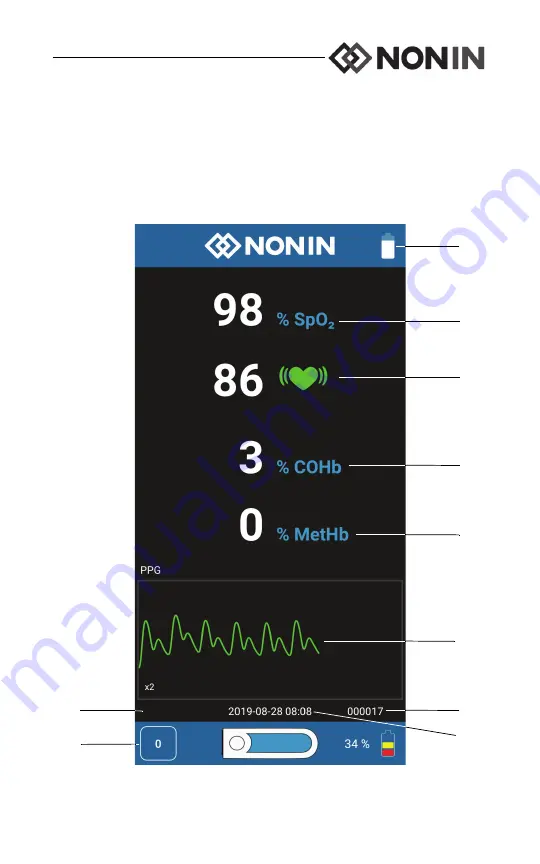 Nonin Sensmart H500 Operator'S Manual Download Page 15