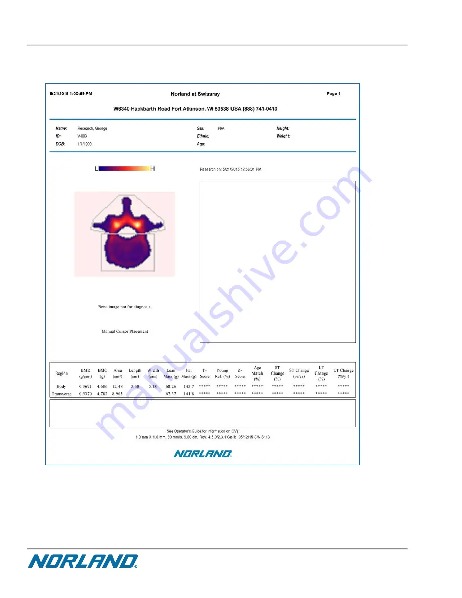 Norland Elite 437A150 Operator'S Manual Download Page 260