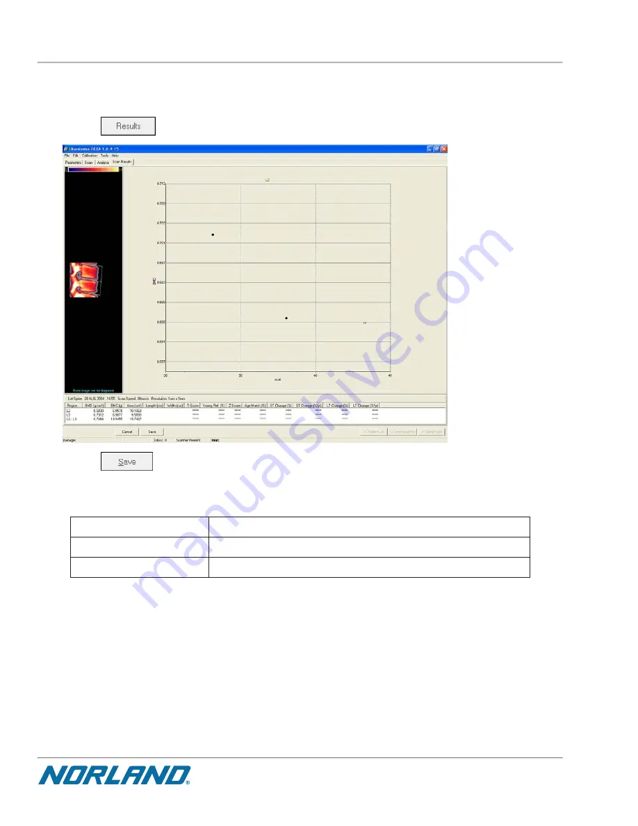 Norland Elite 437A150 Operator'S Manual Download Page 284