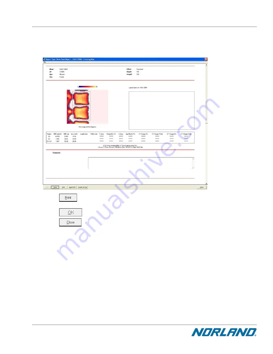 Norland Elite 437A150 Operator'S Manual Download Page 287