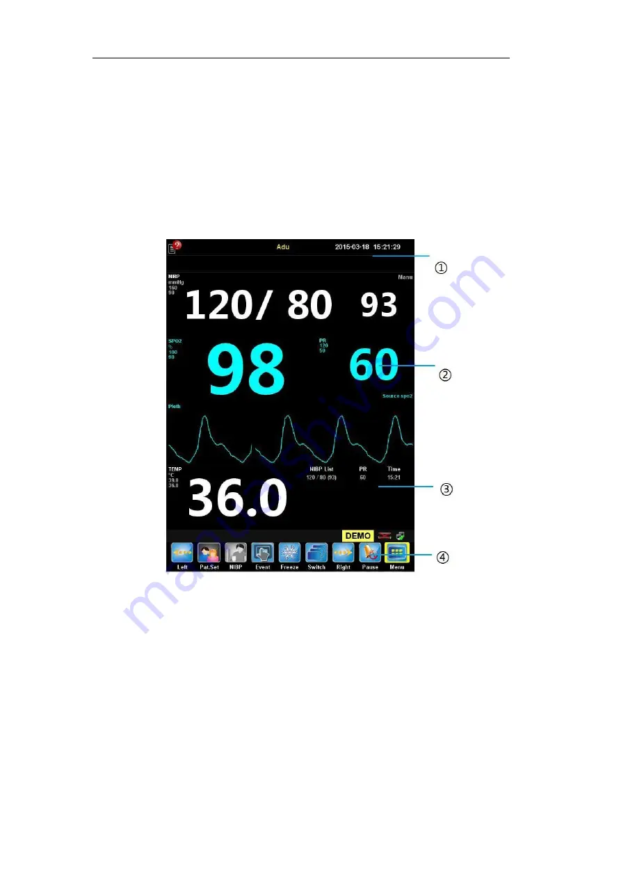 Northern Meditec Taurus E Скачать руководство пользователя страница 27