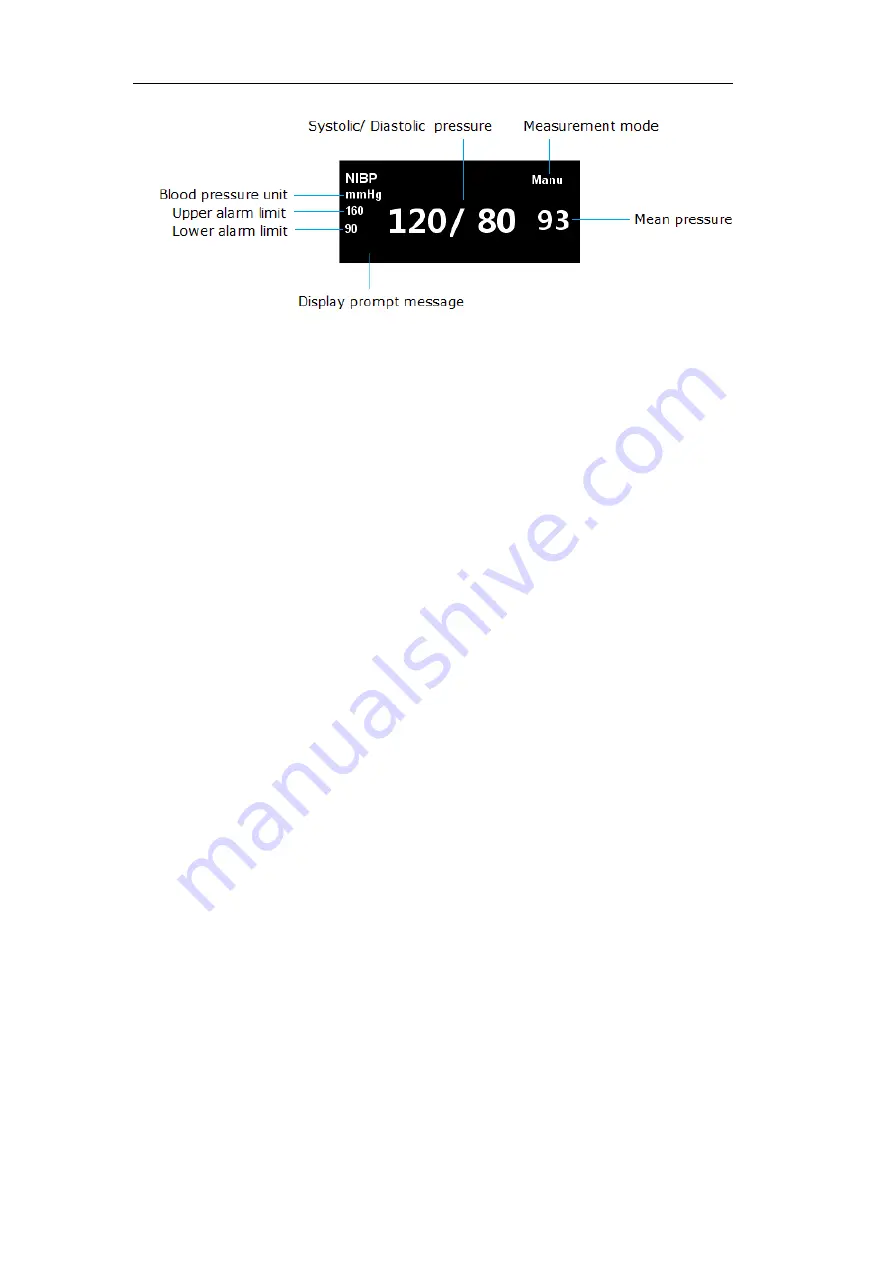 Northern Meditec Taurus E Operator'S Manual Download Page 64