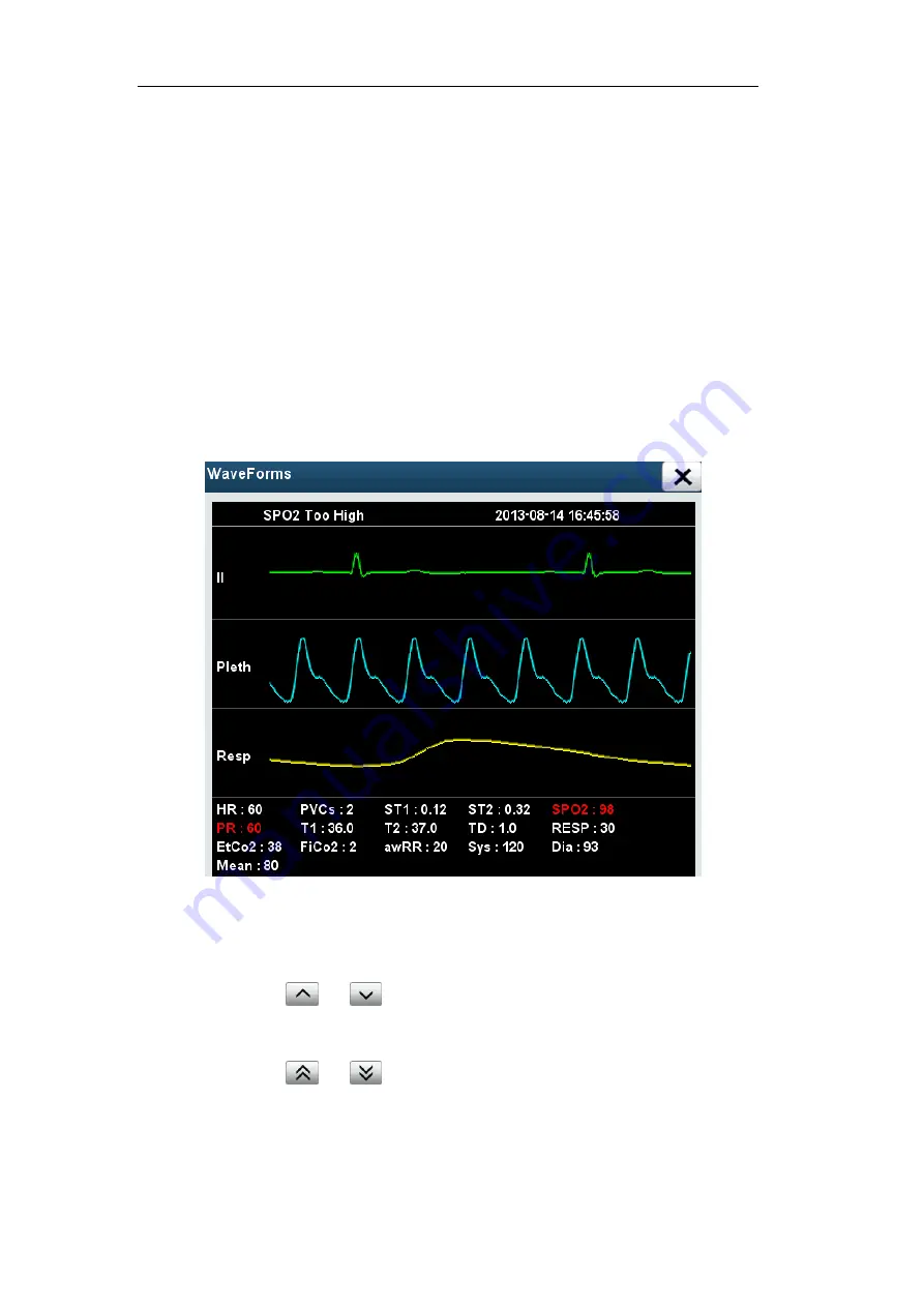 Northern Meditec Taurus E Скачать руководство пользователя страница 82