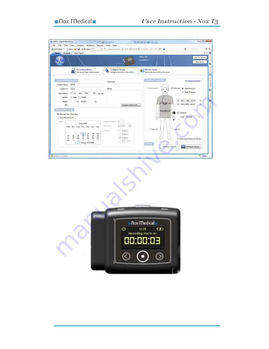 Nox Medical NOX T3 Скачать руководство пользователя страница 20