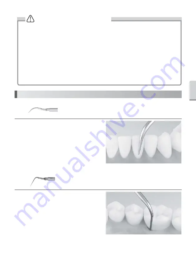 NSK Varios 170 Operation Manual Download Page 26