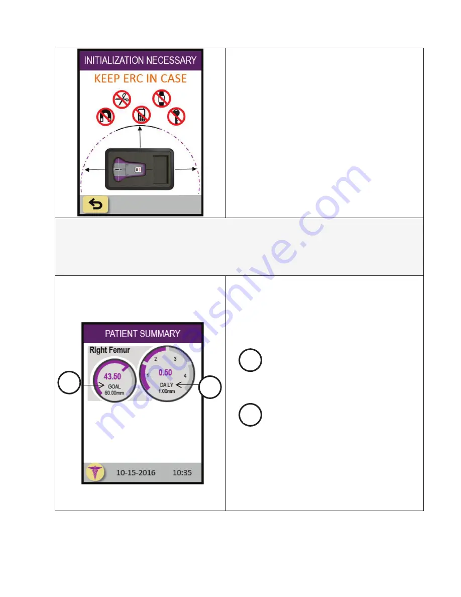 NuVasive ERC 3P Patient Manual Download Page 27