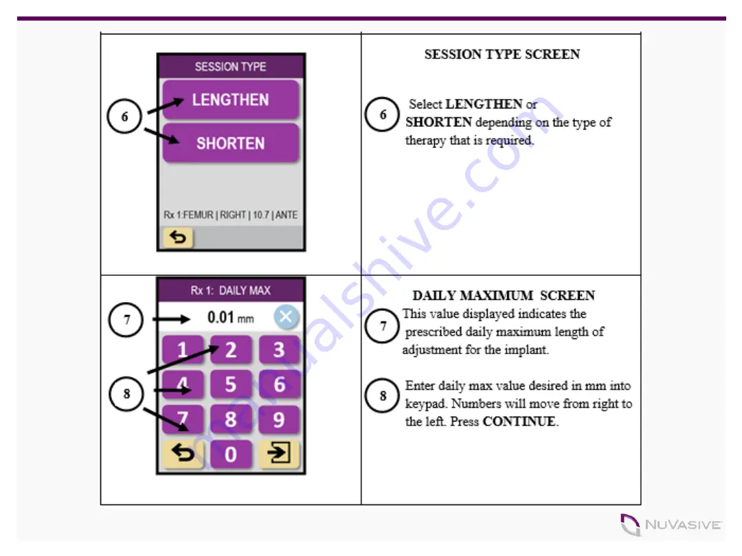 NuVasive PRECICE 3P Manual Download Page 29