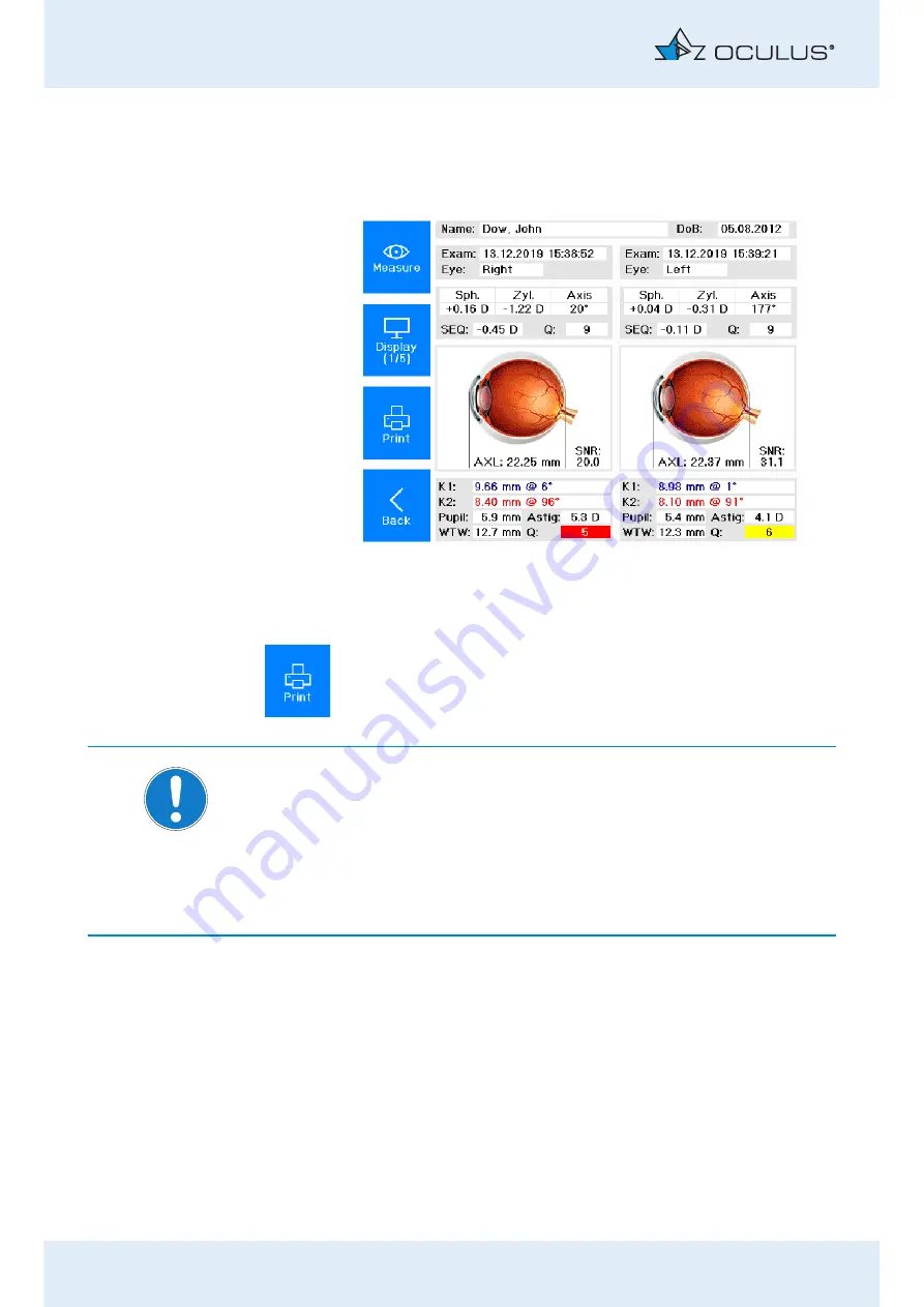 OCULUS Myopia Master Basic Instruction Manual Download Page 49