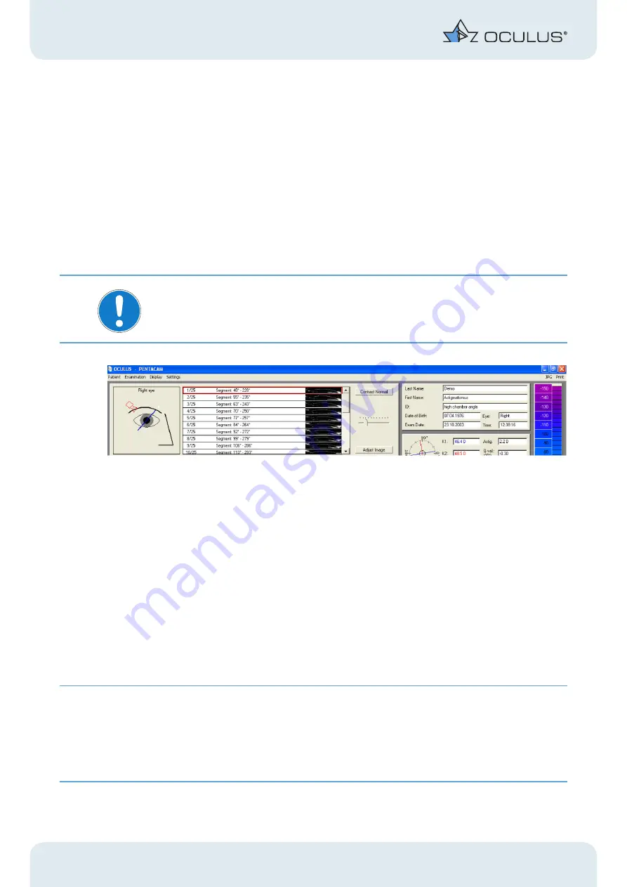 OCULUS Pentacam Instruction Manual Download Page 14