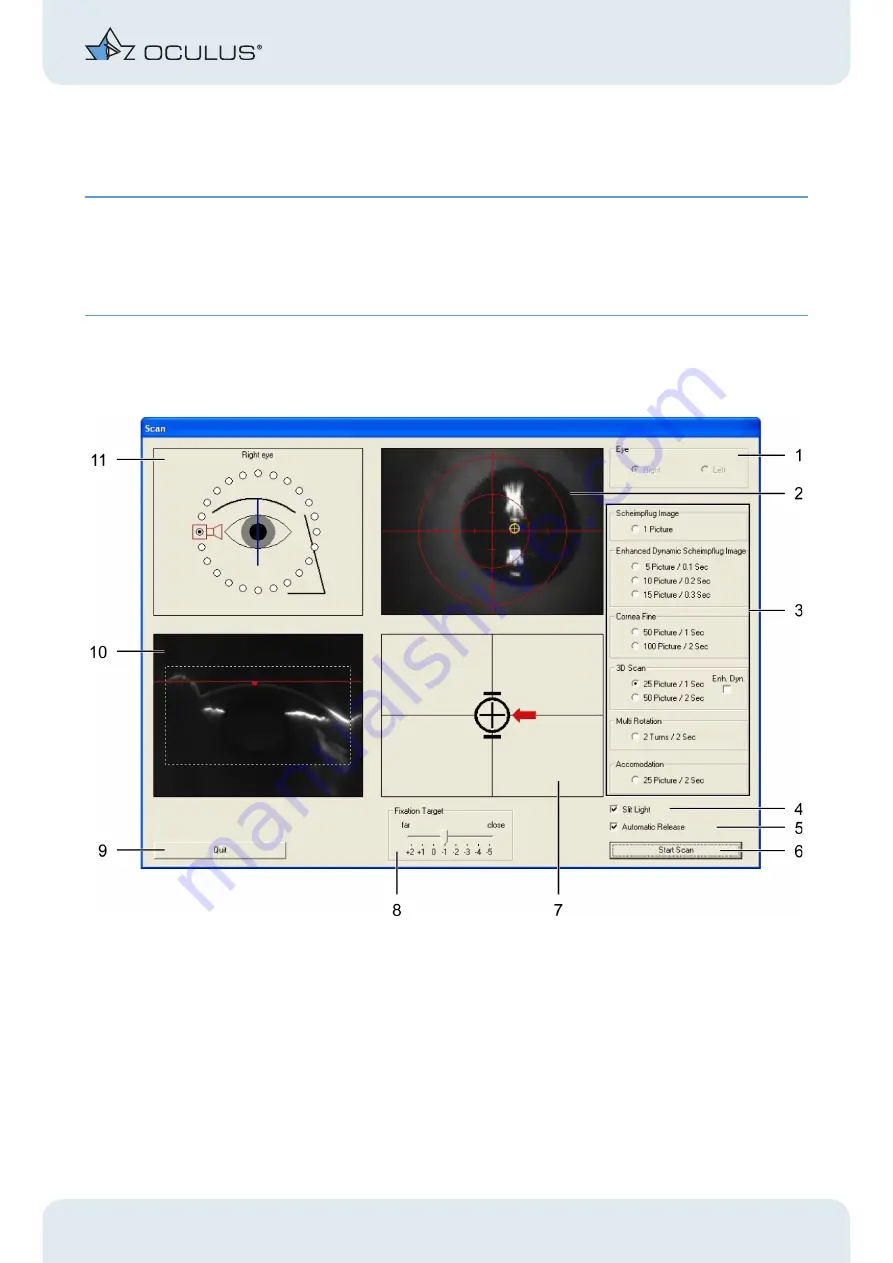 OCULUS Pentacam Instruction Manual Download Page 15