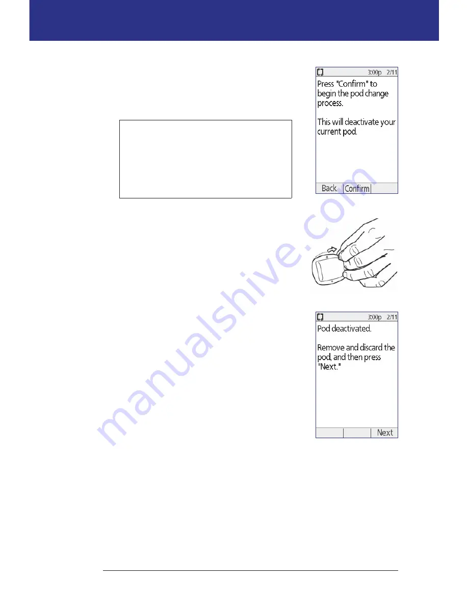 OmniPod UST400 User Manual Download Page 40