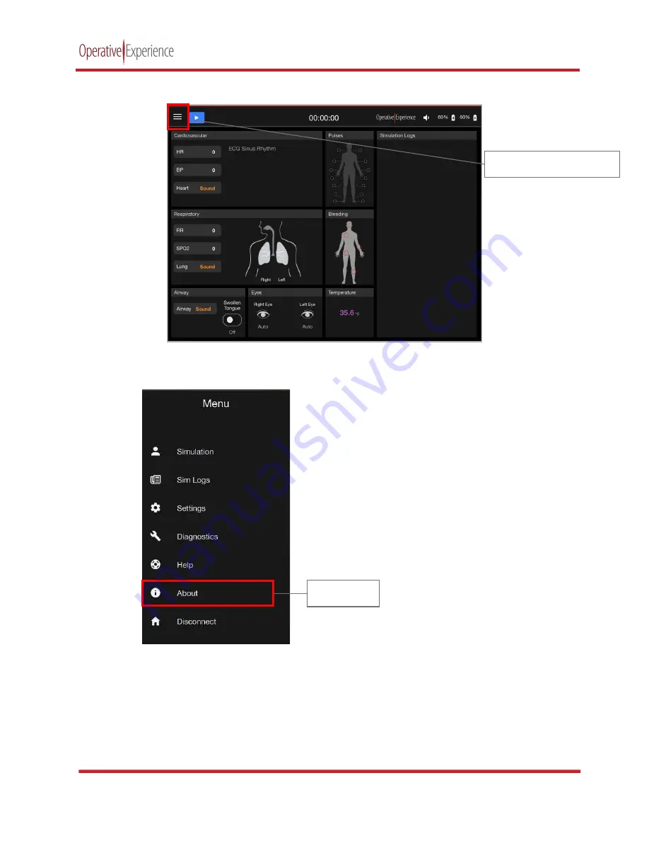 Operative Experience TCCS Plus Manual Download Page 65