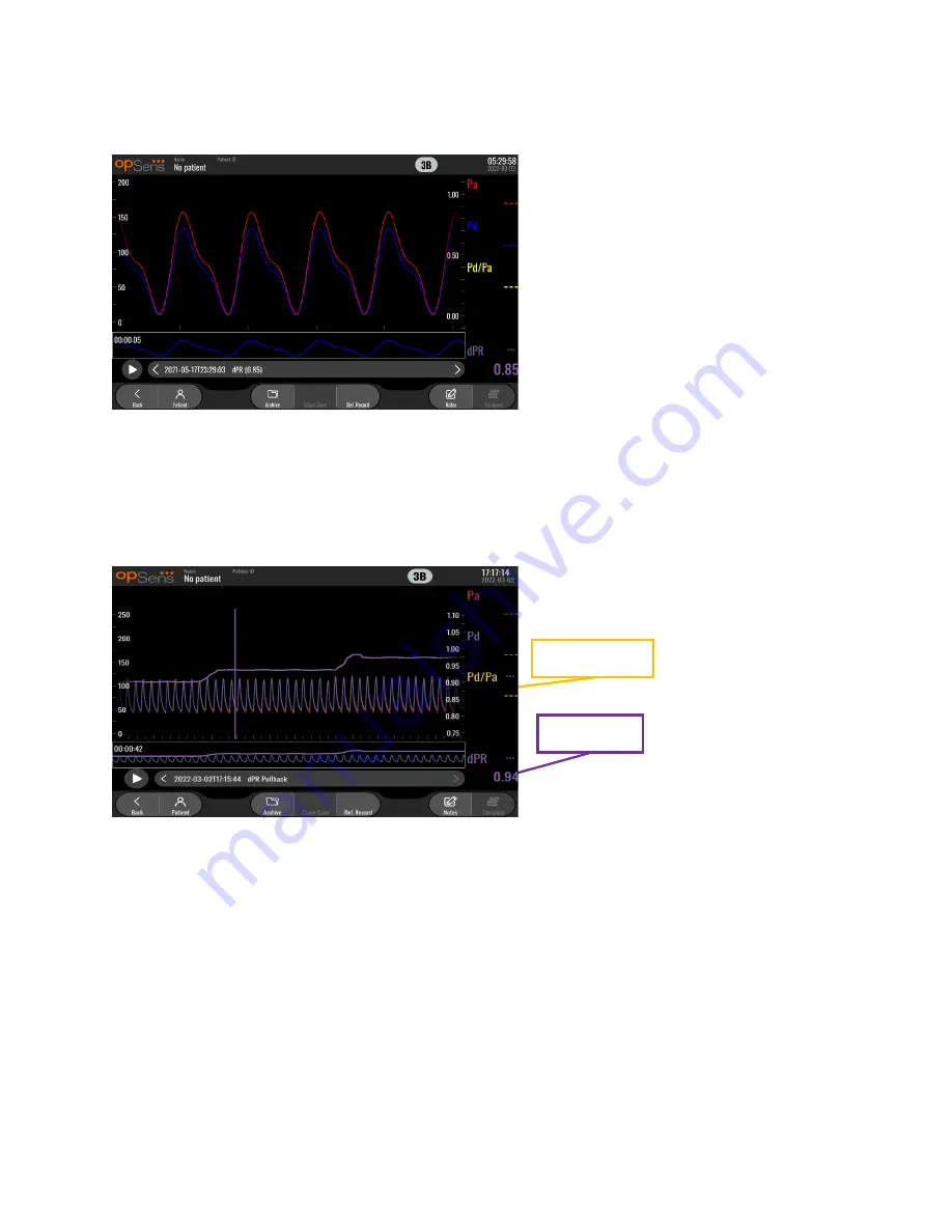 Opsens F2300 Series Instructions For Use Manual Download Page 34