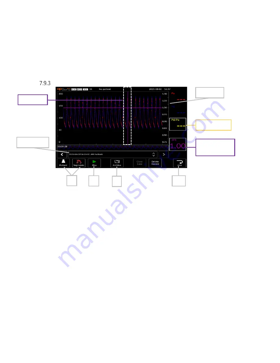 Opsens OptoMonitor 3 Instructions For Use Manual Download Page 66