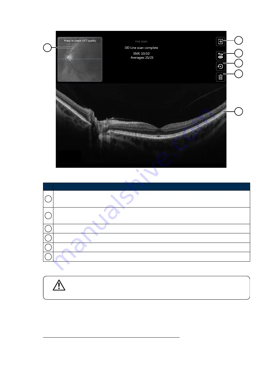 Optos P200TE User Manual Download Page 49