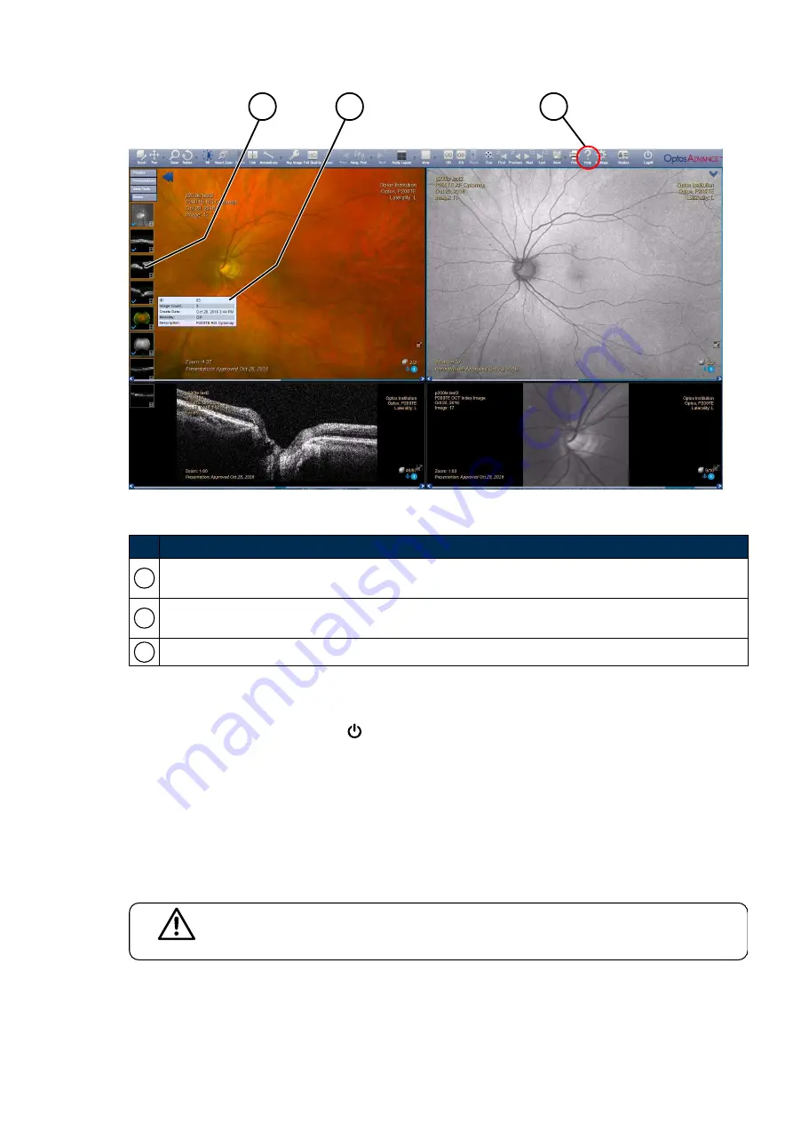 Optos P200TE User Manual Download Page 53