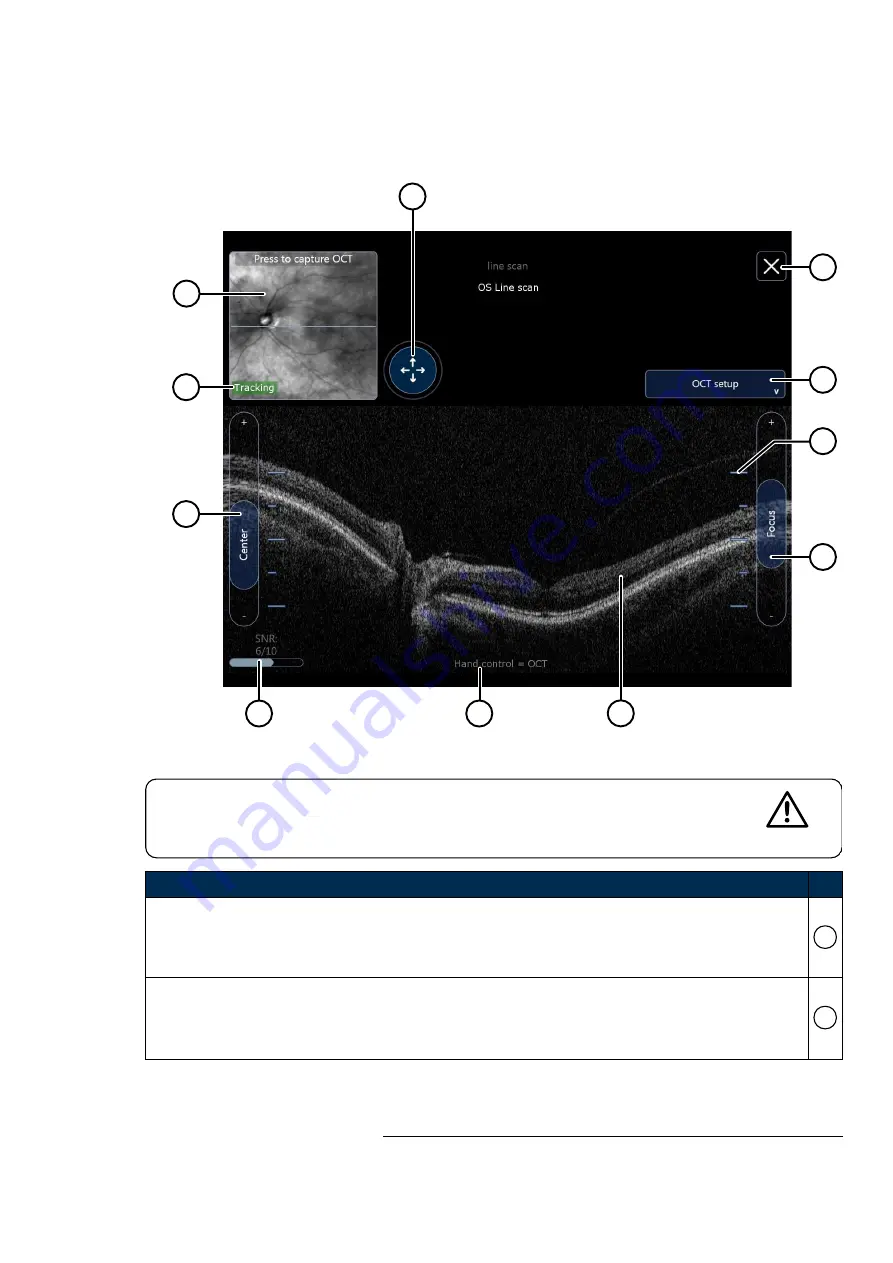 Optos P200TE User Manual Download Page 105