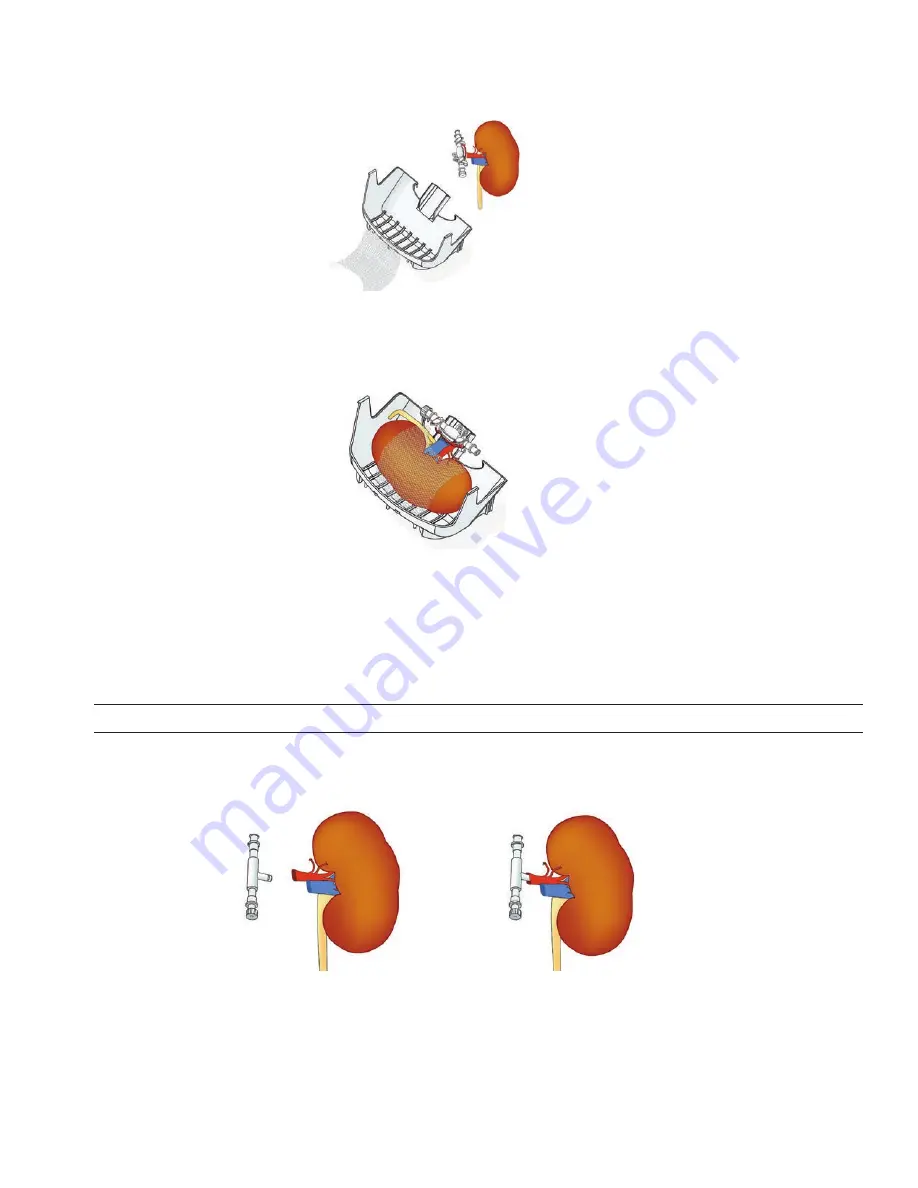 Organ recovery systems LifePort Kidney Transporter LKT101P Operator'S Manual Download Page 29