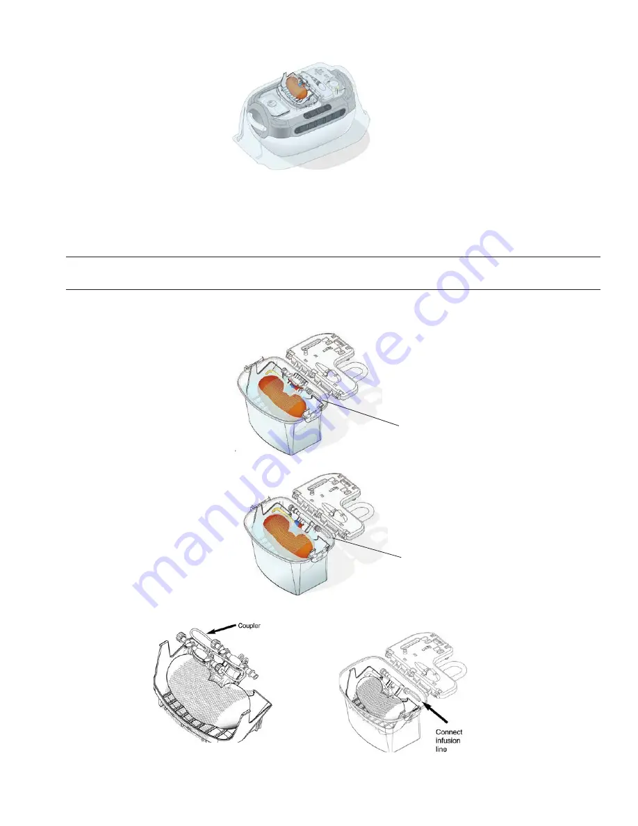 Organ recovery systems LifePort Kidney Transporter LKT101P Operator'S Manual Download Page 36