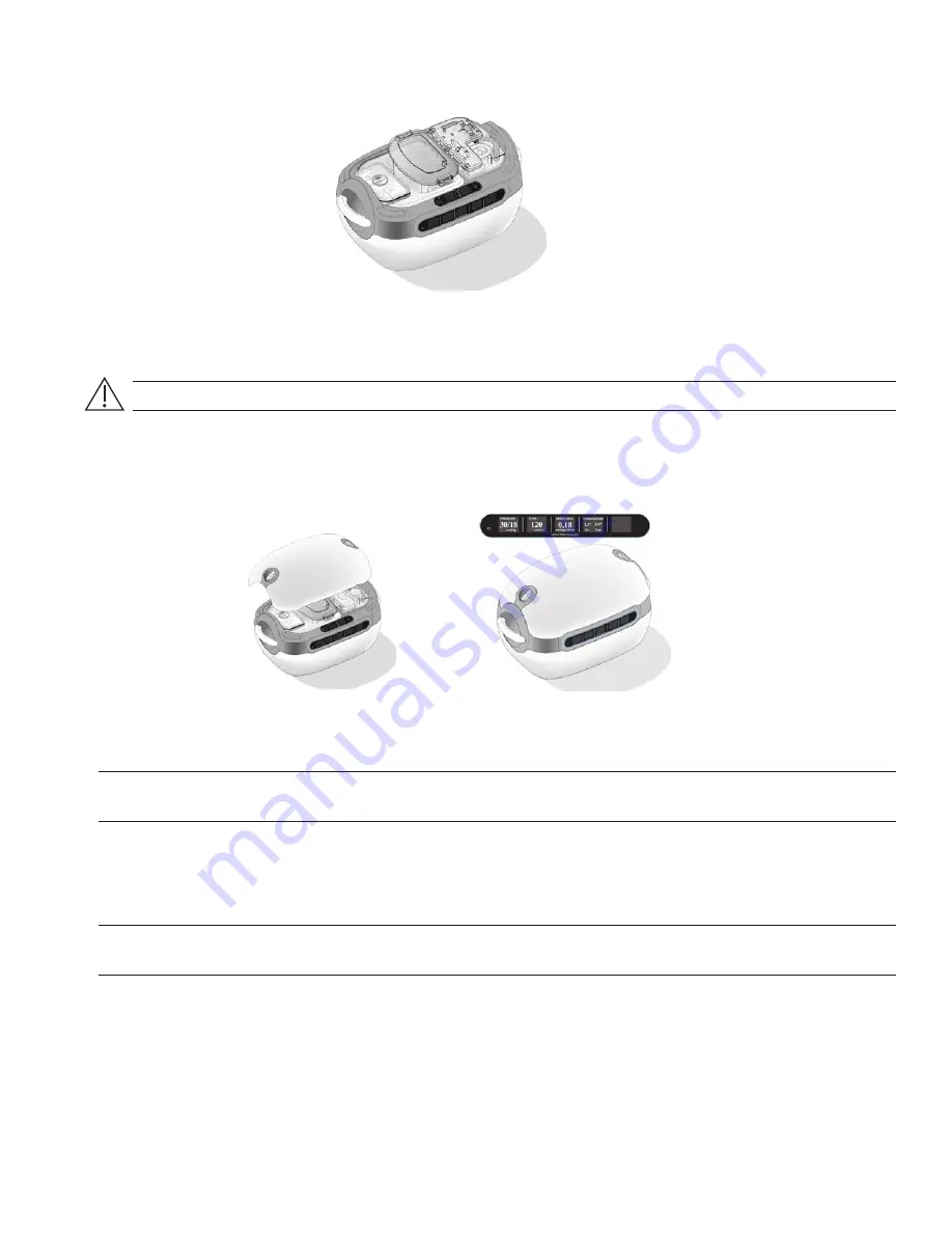 Organ recovery systems LifePort Kidney Transporter LKT101P Operator'S Manual Download Page 40