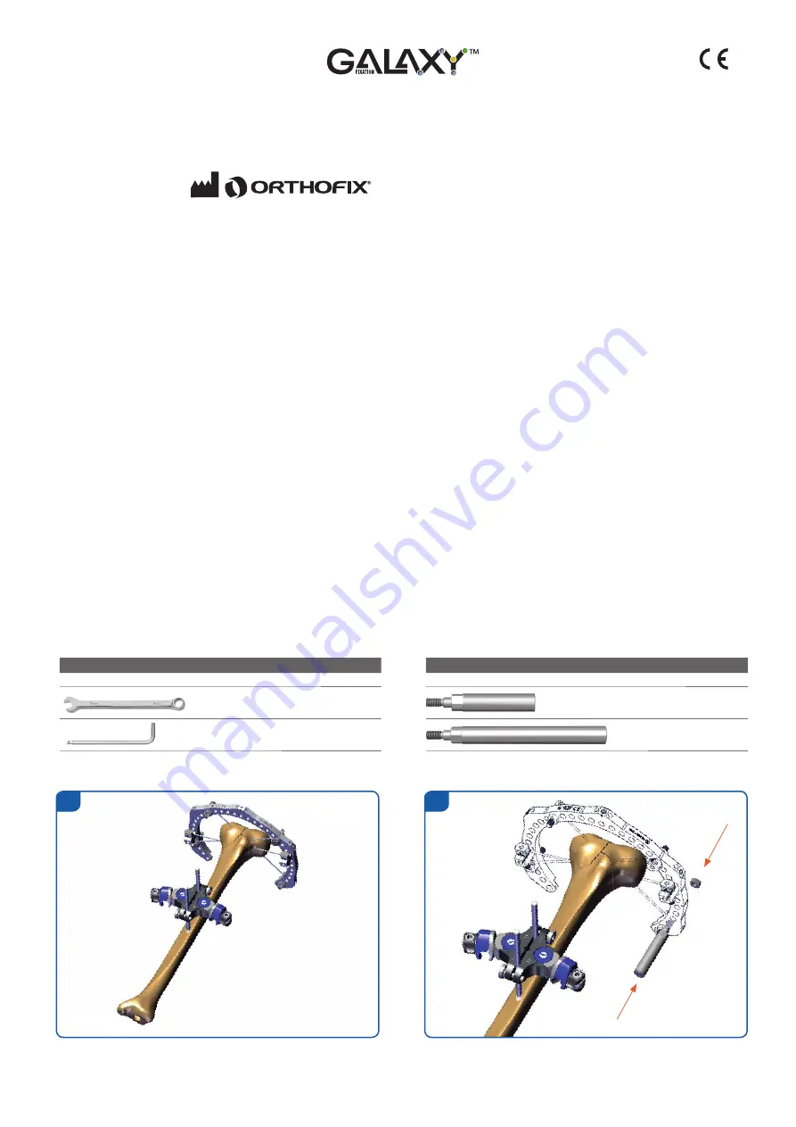 Orthofix Galaxy-TL-HEX Manual Download Page 20