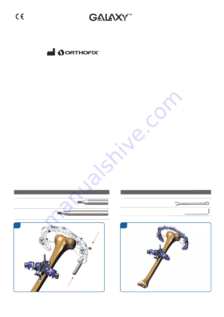 Orthofix Galaxy-TL-HEX Скачать руководство пользователя страница 56
