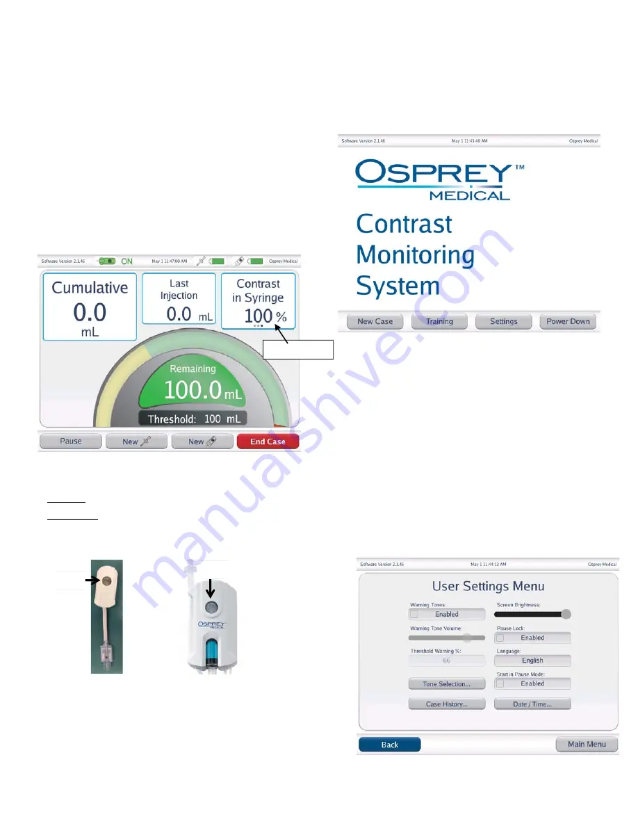 Osprey Medical Display, Contrast Monitoring Скачать руководство пользователя страница 2