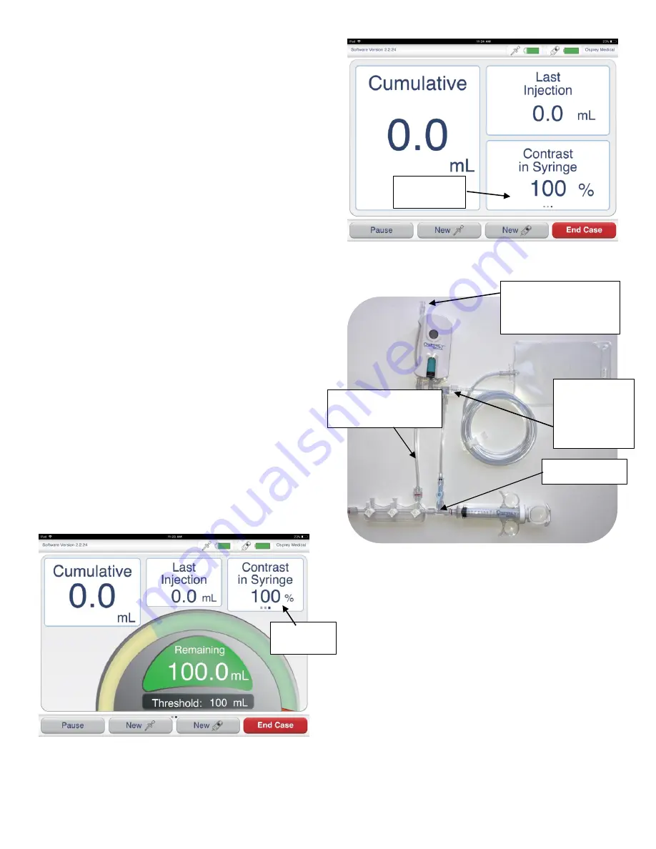 Osprey Medical DyeVer Plus EZ Instructions For Use Manual Download Page 27