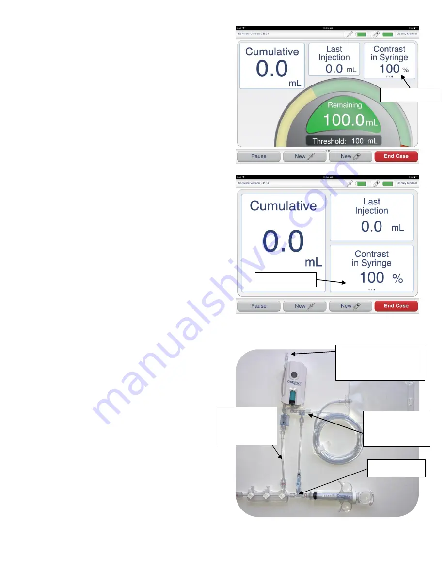 Osprey Medical DyeVer Plus EZ Скачать руководство пользователя страница 42