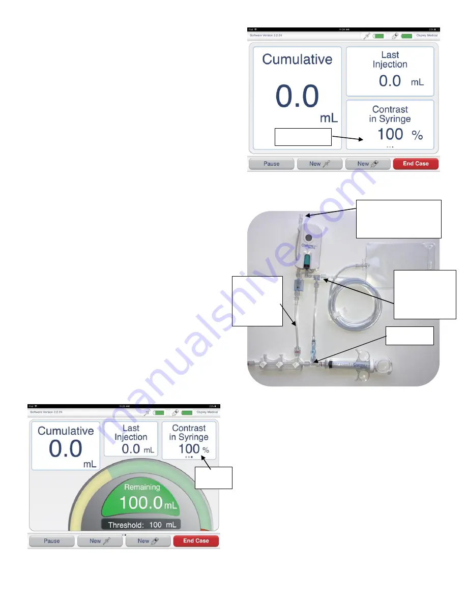 Osprey Medical DyeVer Plus EZ Скачать руководство пользователя страница 87