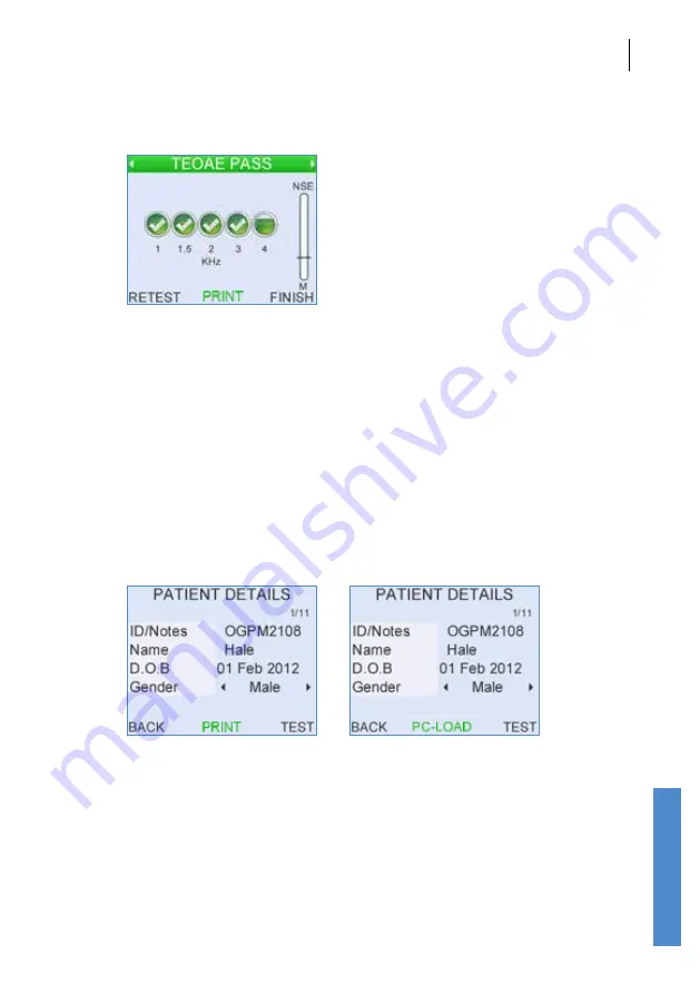 Otodynamics DP Clinical User Manual Download Page 149