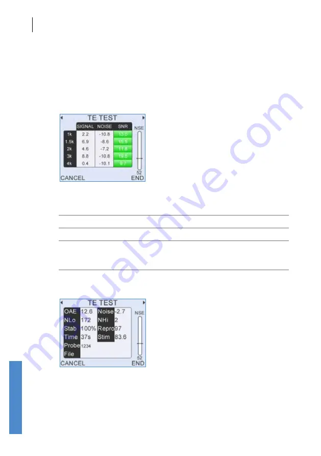 Otodynamics Otoport Advance Скачать руководство пользователя страница 86