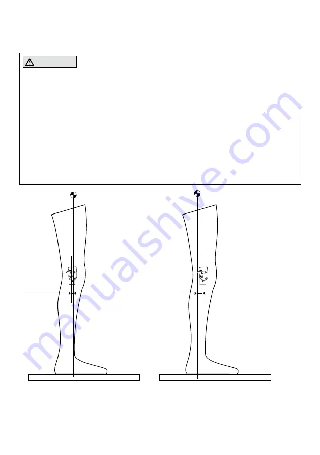 Otto Bock 17LK1-L1-5 Скачать руководство пользователя страница 7