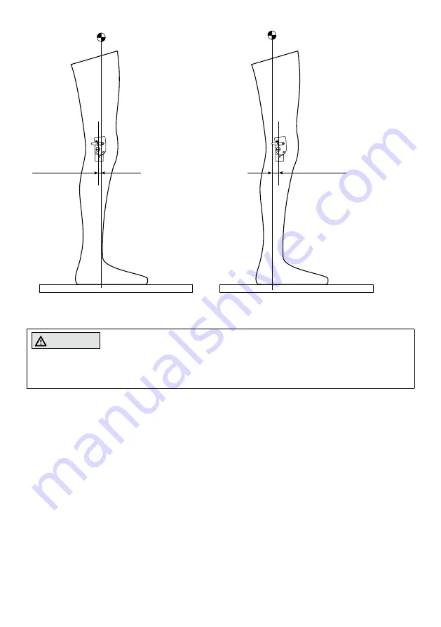 Otto Bock 17LK1-L1-5 Скачать руководство пользователя страница 12