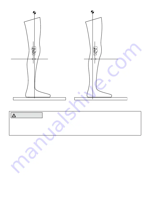 Otto Bock 17LK1-L1-5 Скачать руководство пользователя страница 36