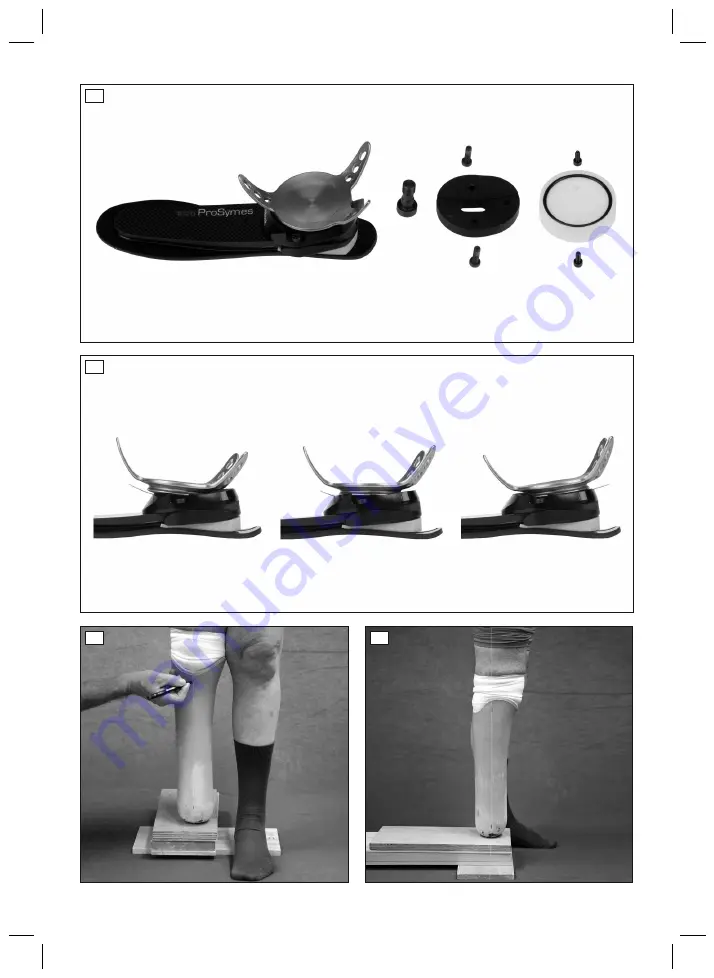 Otto Bock 1C20 ProSymes Скачать руководство пользователя страница 2