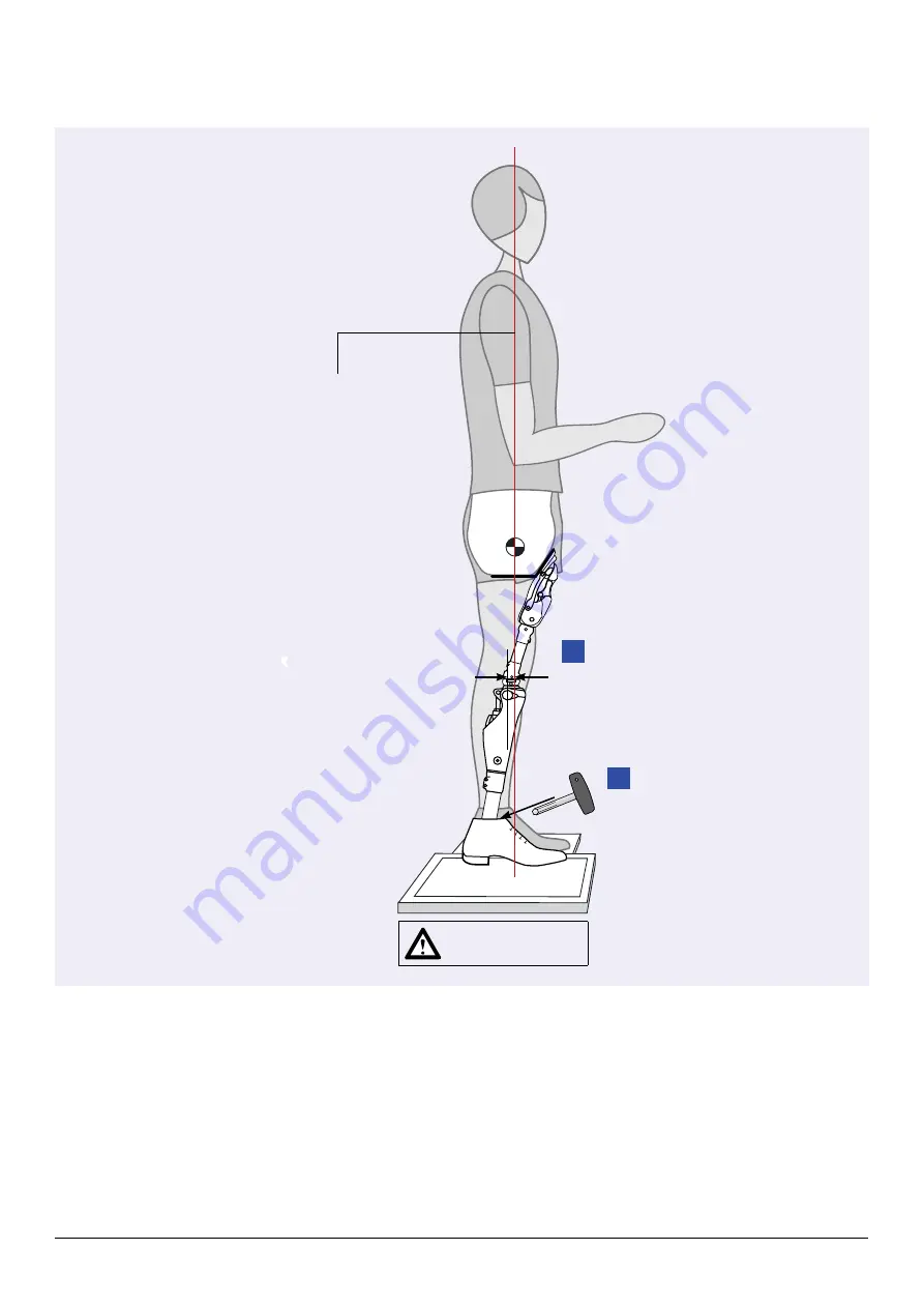 Otto Bock 7E10 Helix 3D Instructions For Use Manual Download Page 104