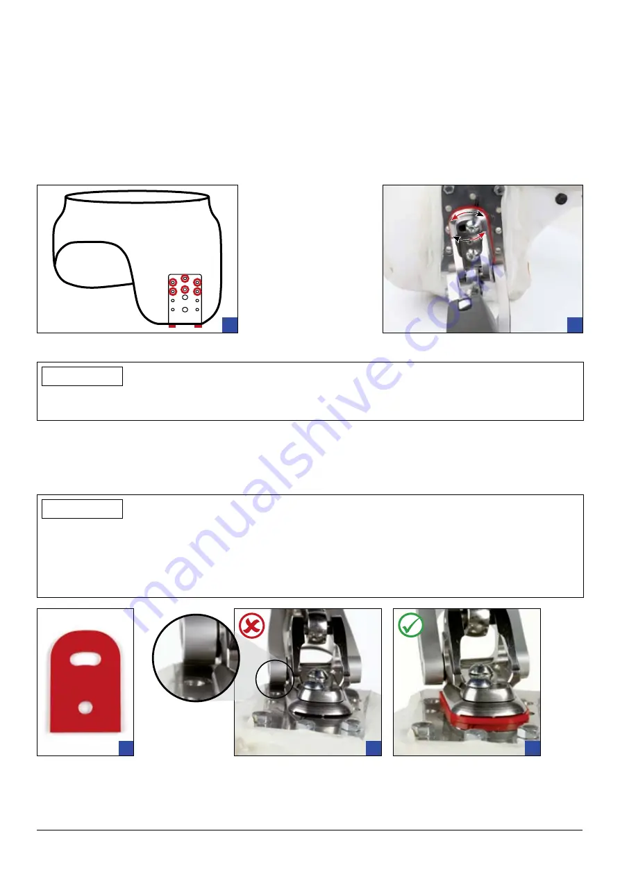 Otto Bock 7E10 Helix 3D Скачать руководство пользователя страница 144